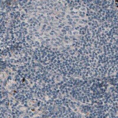 Immunohistochemistry-Paraffin: Laminin alpha 3 Antibody (CL3112) [NBP2-42390]