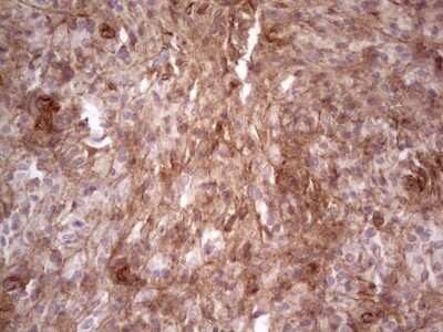 Immunohistochemistry: Laminin alpha 4 Antibody (OTI5G8) [NBP2-45582]
