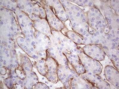 Immunohistochemistry: Laminin alpha 4 Antibody (OTI5G8) - Azide and BSA Free [NBP2-71113]
