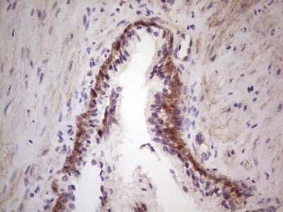 Immunohistochemistry: Laminin alpha 4 Antibody (OTI5G8) - Azide and BSA Free [NBP2-71113]