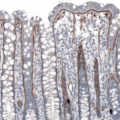 Immunohistochemistry-Paraffin: Laminin alpha 5 Antibody (CL3118) [NBP2-42391]