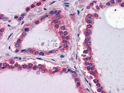 Immunohistochemistry-Paraffin: Laminin beta 1 Antibody (2D9G5) - BSA Free [NBP1-51558]