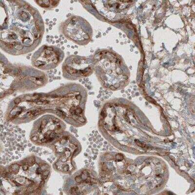 Immunohistochemistry-Paraffin: Laminin beta 1 Antibody (CL2970) [NBP2-42385]