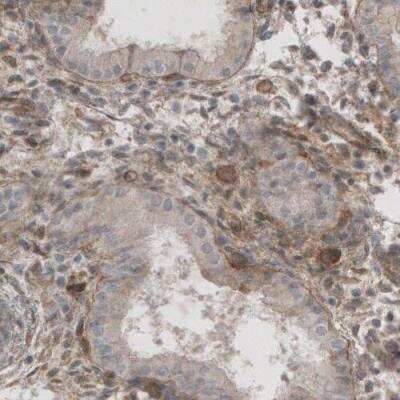 Immunohistochemistry-Paraffin: Laminin beta 1 Antibody (CL2970) [NBP2-42385]