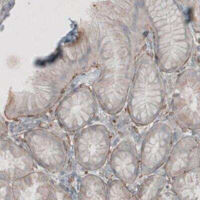 Immunohistochemistry-Paraffin: Laminin beta 1 Antibody (CL2970) [NBP2-42385]