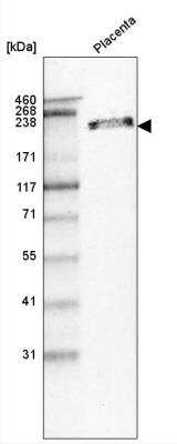 Western Blot: Laminin beta 1 Antibody (CL2970) [NBP2-42385]
