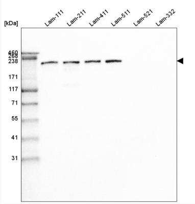 Western Blot: Laminin beta 1 Antibody (CL2970) [NBP2-42385]
