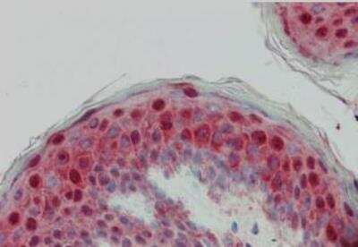 Immunohistochemistry: Laminin beta 1 Antibody [NB120-6571]