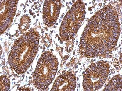 Immunohistochemistry-Paraffin: Laminin beta 1 Antibody [NBP1-32043]
