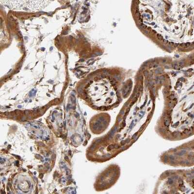 Immunohistochemistry-Paraffin: Laminin beta 1 Antibody [NBP1-88073]
