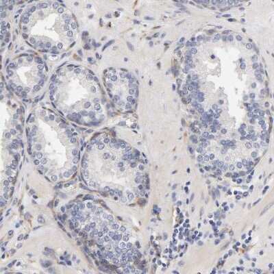 Immunohistochemistry-Paraffin: Laminin beta 1 Antibody [NBP1-88073]