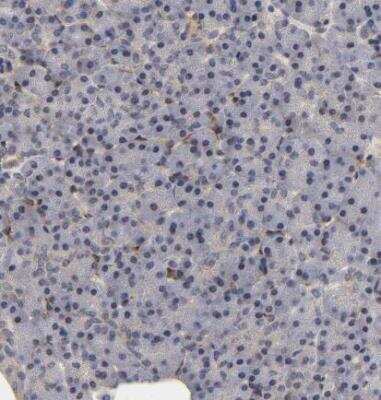 Immunohistochemistry-Paraffin: Laminin beta 1 Antibody [NBP1-88074]