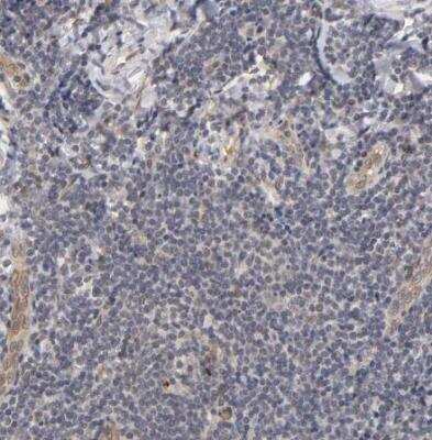 Immunohistochemistry-Paraffin: Laminin beta 1 Antibody [NBP1-88074]