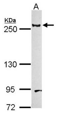 Western Blot: Laminin beta 1 Antibody [NBP1-32043]