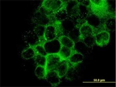 Immunocytochemistry/ Immunofluorescence: Laminin beta 3 Antibody (2G10) [H00003914-M01]