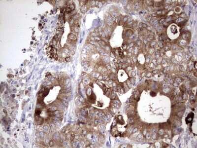 Immunohistochemistry: Laminin beta 3 Antibody (OTI3A2) [NBP2-45596]