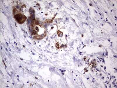Immunohistochemistry: Laminin beta 3 Antibody (OTI3A2) [NBP2-45596]