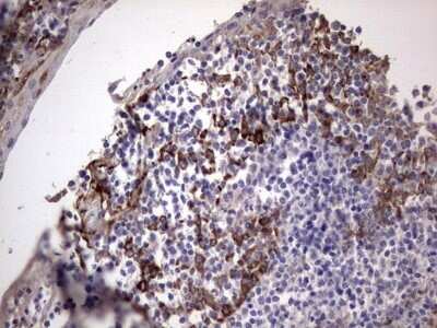 Immunohistochemistry: Laminin beta 3 Antibody (OTI3A2) - Azide and BSA Free [NBP2-71115]