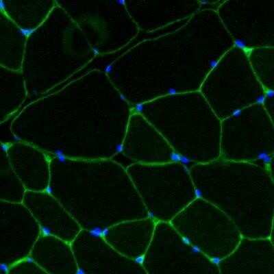 Immunohistochemistry-Frozen: Laminin gamma 1 Antibody (A5) - IHC-Prediluted [NBP2-48357]
