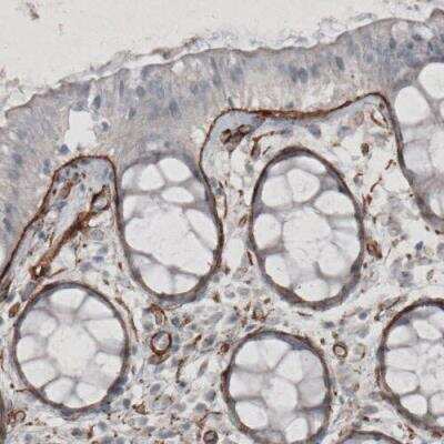 Immunohistochemistry-Paraffin: Laminin gamma 1 Antibody (CL3195) [NBP2-42394]