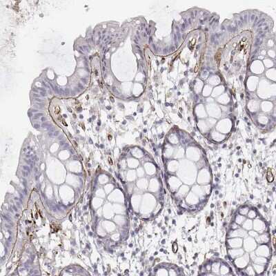 Immunohistochemistry-Paraffin: Laminin gamma 1 Antibody (CL3199) [NBP2-42396]