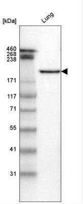 Western Blot: Laminin gamma 1 Antibody (CL3199) [NBP2-42396]