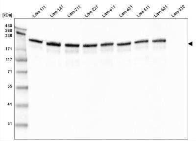 Western Blot: Laminin gamma 1 Antibody (CL3199) [NBP2-42396]