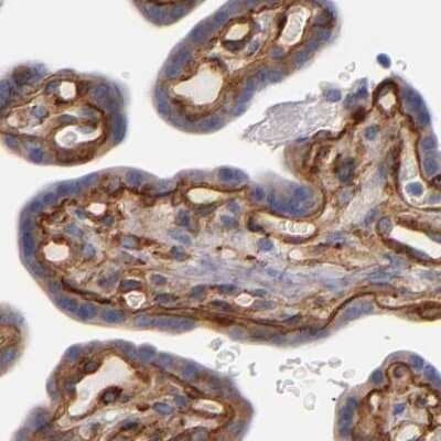 Immunohistochemistry-Paraffin: Laminin gamma 1 Antibody [NBP1-87718]
