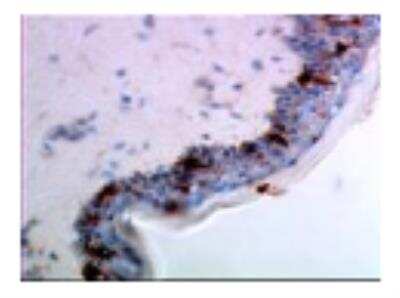 Immunohistochemistry: Langerin/CD207 Antibody (306G9) [DDX0368P-100]