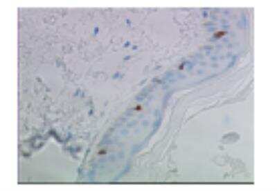 Immunohistochemistry: Langerin/CD207 Antibody (306G9) [DDX0368P-100]