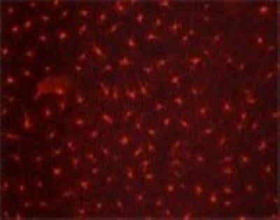 Immunocytochemistry/ Immunofluorescence: Langerin/CD207 Antibody (918A11) [DDX0376P-100]