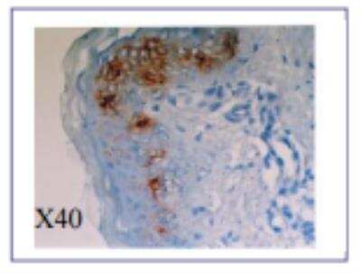 Immunohistochemistry: Langerin/CD207 Antibody (923B7) [DDX0373P-100]