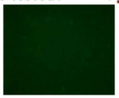 Immunohistochemistry: Langerin/CD207 Antibody (DCGM4/122D5) [DDX0363P-100]