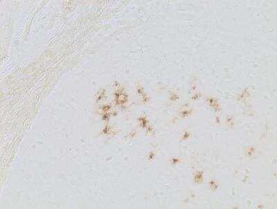 Immunohistochemistry-Paraffin: Langerin/CD207 Antibody [NB100-56733]