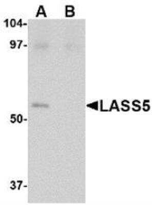 Western Blot: Lass5 Antibody Blocking Peptide [NBP1-77328PEP]