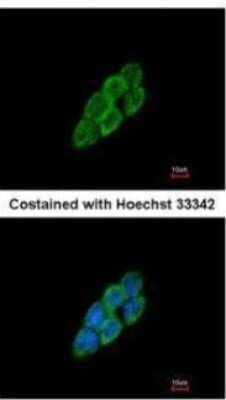 Immunocytochemistry/ Immunofluorescence: Latent TGF-beta bp4 Antibody [NBP2-43671]