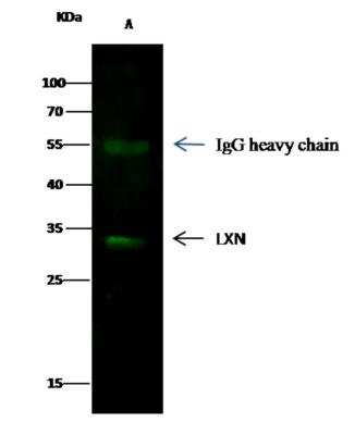 Immunoprecipitation: Latexin Antibody (8E1G6C1D4) [NBP3-06087]