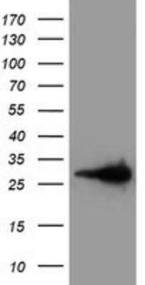 Western Blot: Latexin Antibody (OTI1E10)Azide and BSA Free [NBP2-72069]