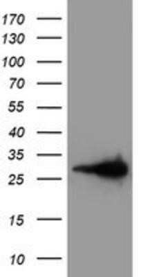 Western Blot: Latexin Antibody (OTI1E10) [NBP2-01382]