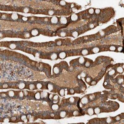 Immunohistochemistry-Paraffin: Latrophilin 3/LPHN3 Antibody [NBP1-82963]