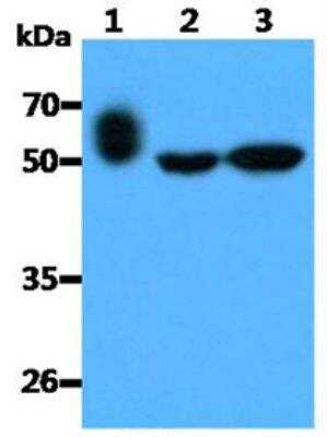 Western Blot: Layilin Antibody (20G8)BSA Free [NBP2-42663]