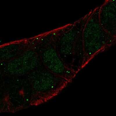 Immunocytochemistry/ Immunofluorescence: Legumain/Asparaginyl Endopeptidase Antibody [NBP1-87793]