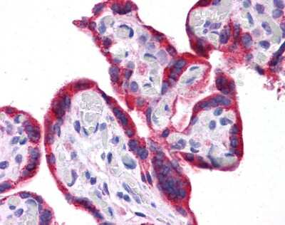 Immunohistochemistry-Paraffin: Leptin/OB Antibody [NBP1-59320]