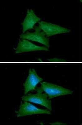 Immunocytochemistry/ Immunofluorescence: Leptin/OB Antibody (7E10) - BSA Free [NBP2-59497]