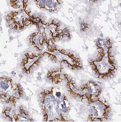 Immunohistochemistry-Paraffin: Leptin R Antibody [NBP1-85765]