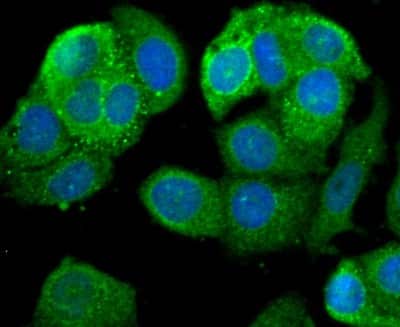 Immunocytochemistry/ Immunofluorescence: Leptin R Antibody (JA73-01) [NBP2-66931]