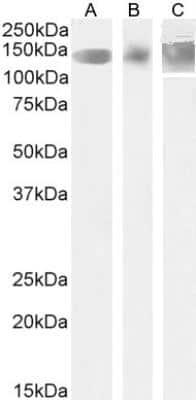 Western Blot: Leptin R Antibody [NB100-40796]