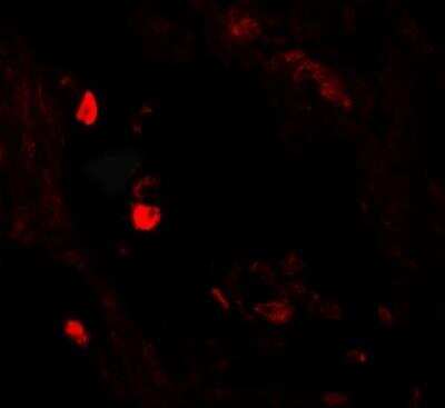 Immunocytochemistry/ Immunofluorescence: Leucyl-cystinyl Aminopeptidase/LNPEP Antibody - BSA Free [NBP2-81854]