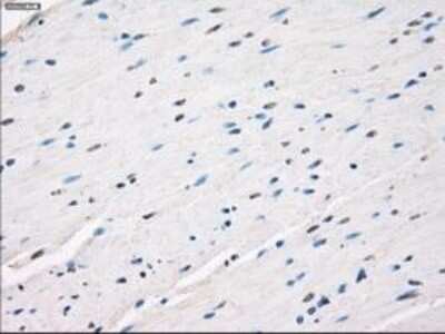 Immunohistochemistry: Leukotriene A4 Hydrolase/LTA4H Antibody (OTI1E9) - Azide and BSA Free [NBP2-71189]