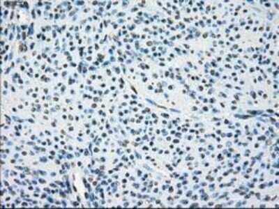 Immunohistochemistry: Leukotriene A4 Hydrolase/LTA4H Antibody (OTI1E9) - Azide and BSA Free [NBP2-71189]